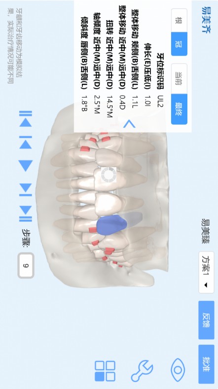 美齐助手